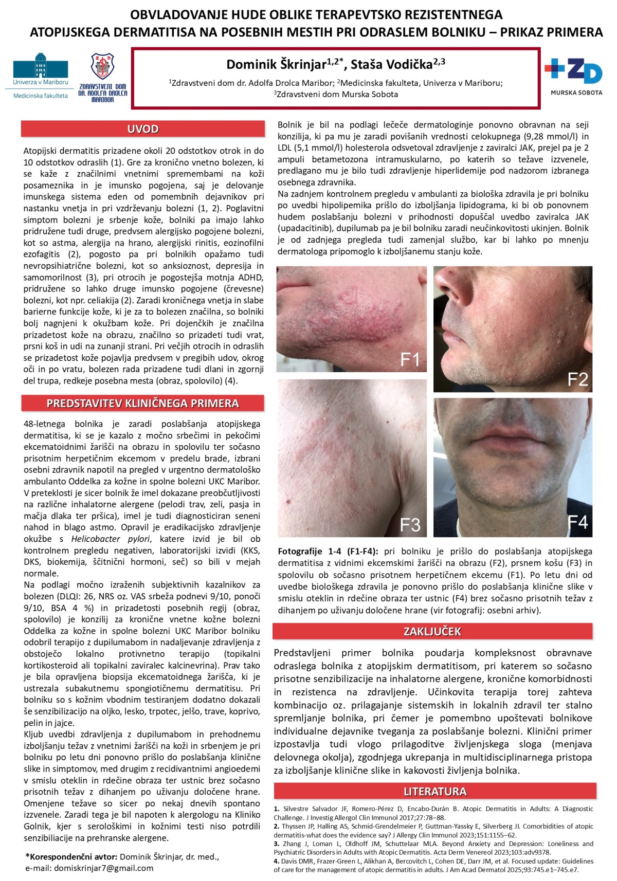 OBVLADOVANJE HUDE OBLIKE TERAPEVTSKO REZISTENTNEGA ATOPIJSKEGA DERMATITISA NA POSEBNIH MESTIH PRI ODRASLEM BOLNIKU – PRIKAZ PRIMERA