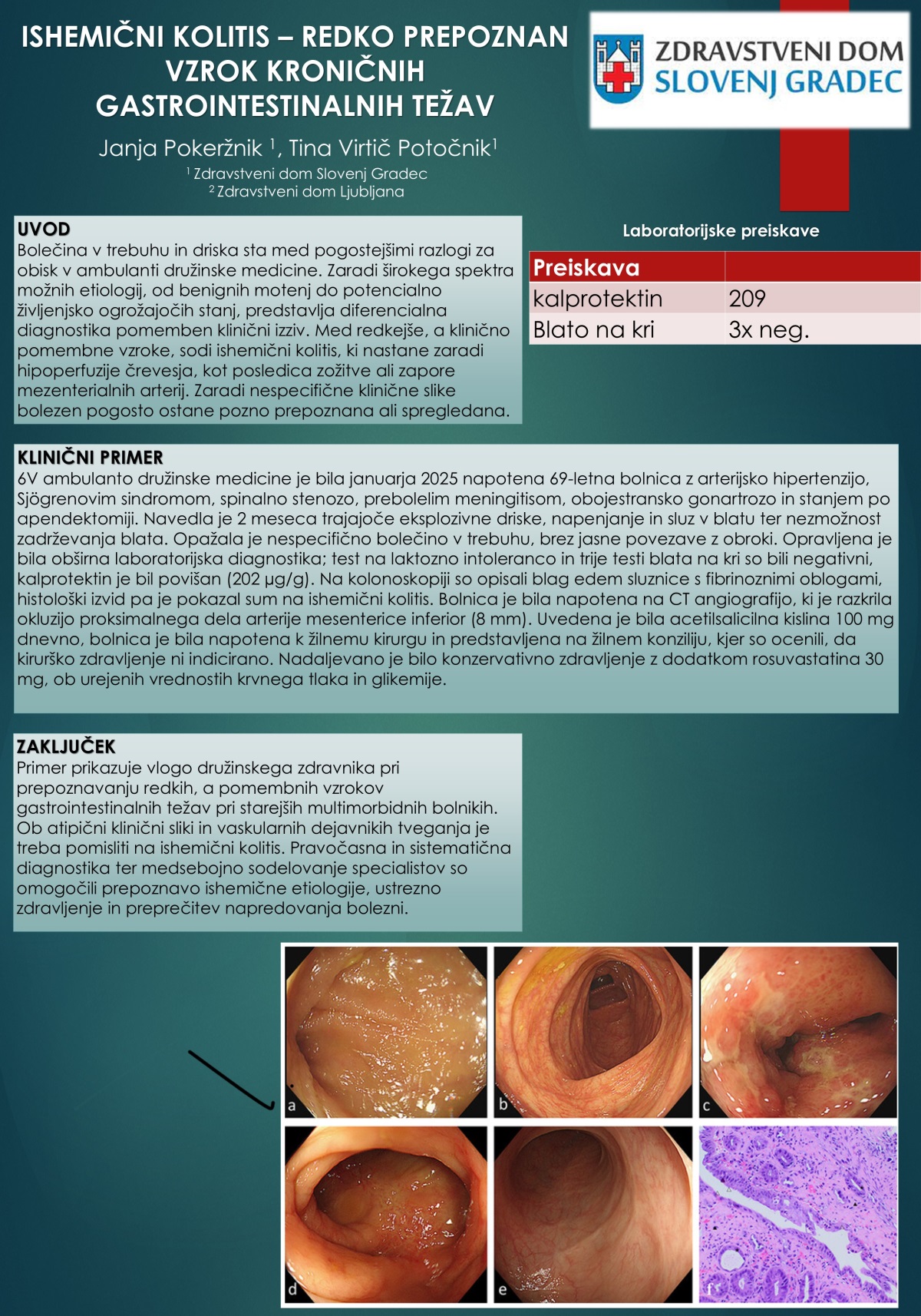 ISHEMIČNI KOLITIS – REDKO PREPOZNANI VZROK KRONIČNIH GASTROINTESTINALNIH TEŽAV