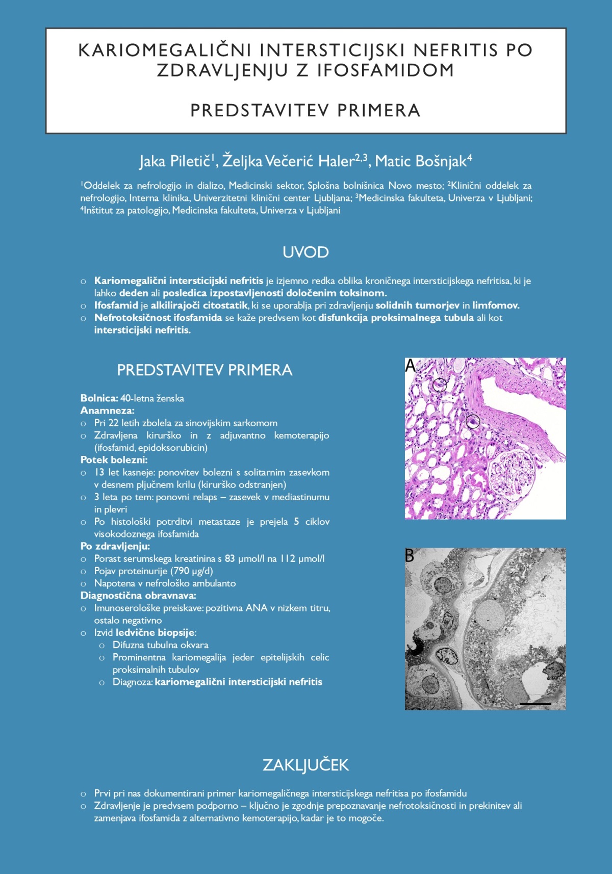 KARIOMEGALIČNI INTERSTICIJSKI NEFRITIS PO ZDRAVLJENJU Z IFOSFAMIDOM – PRIKAZ PRIMERA