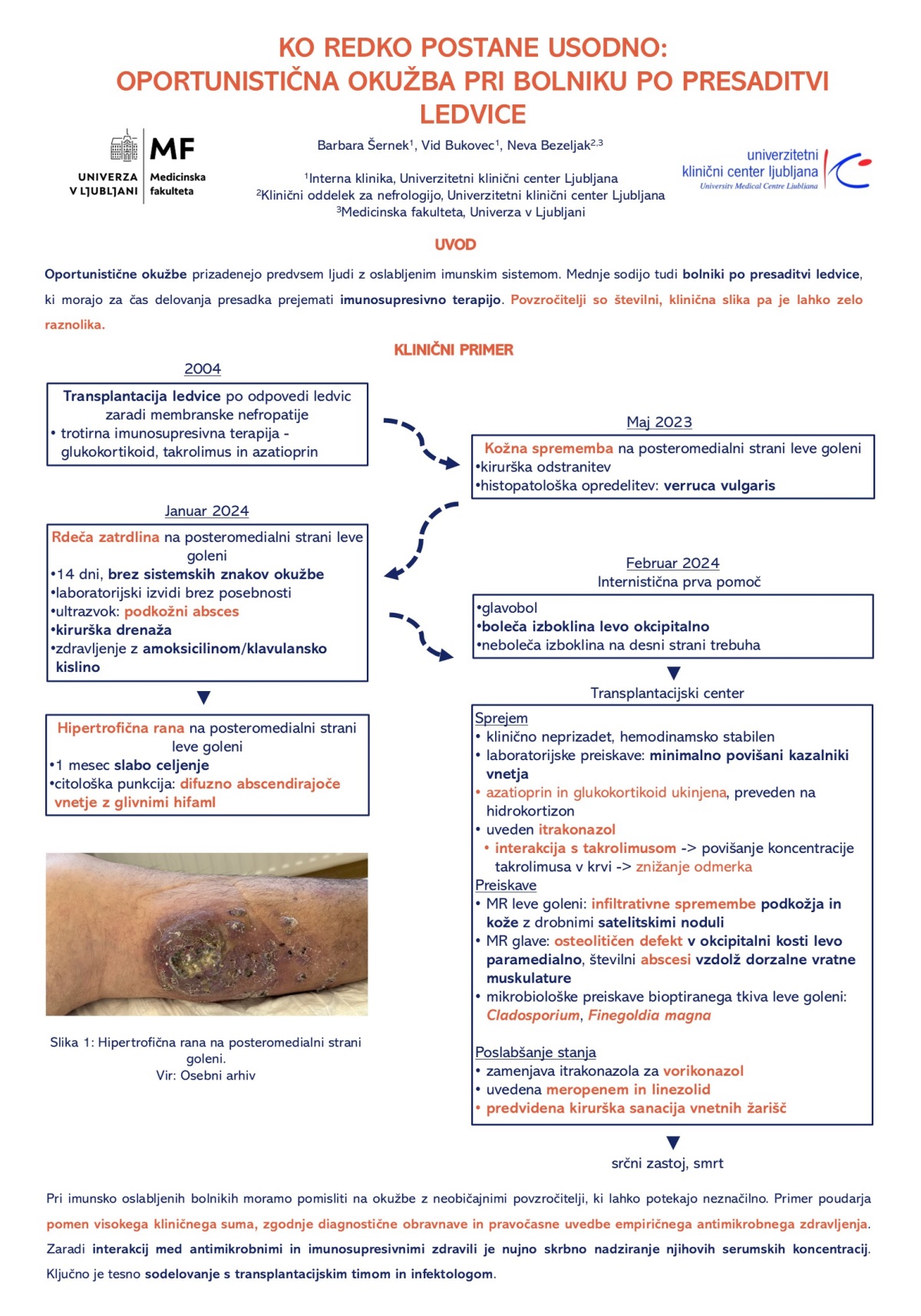 KO REDKO POSTANE USODNO – OPORTUNISTIČNA OKUŽBA PRI BOLNIKU PO PRESADITVI LEDVICE