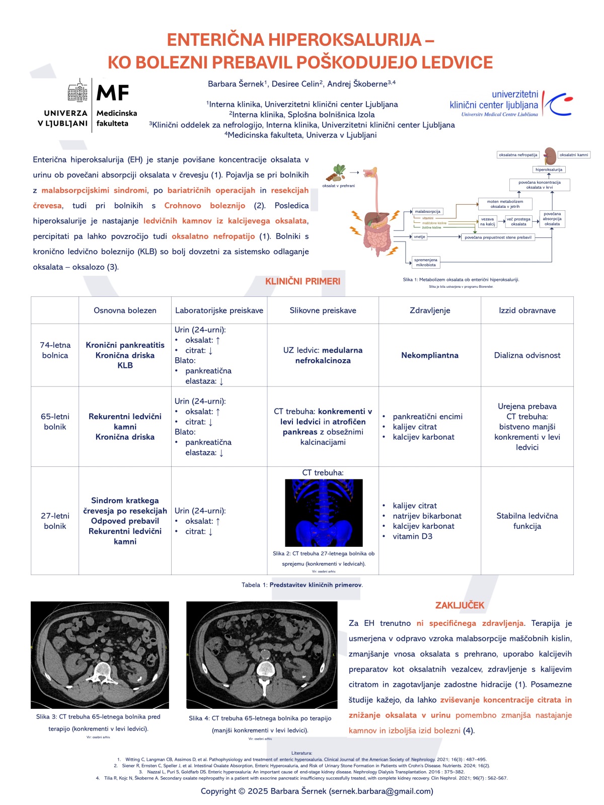 ENTERIČNA HIPEROKSALURIJA – KO BOLEZNI PREBAVIL POŠKODUJEJO LEDVICE