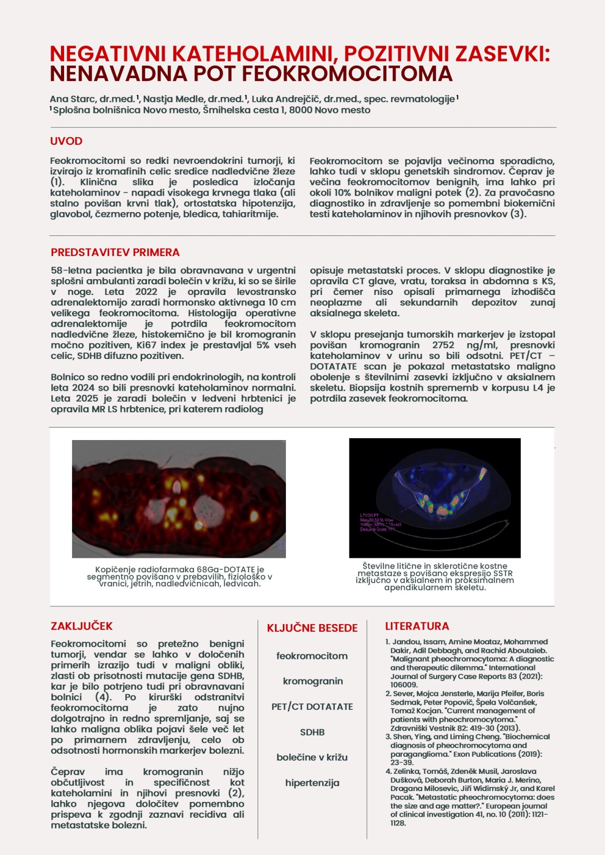 NEGATIVNI KATEHOLAMINI, POZITIVNI ZASEVKI – NENAVADNA POT FEOKROMOCITOMA