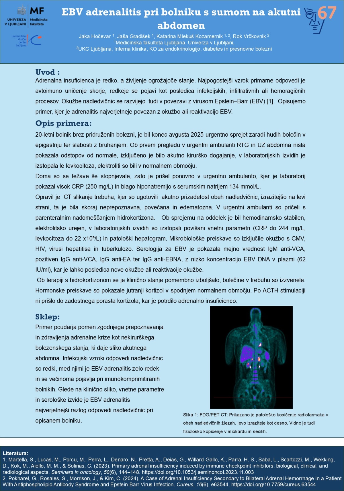 ADRENALITIS POVEZAN Z VIRUSOM EPSTEIN-BARR PRI BOLNIKU S SUMOM NA AKUTNI ABDOMEN