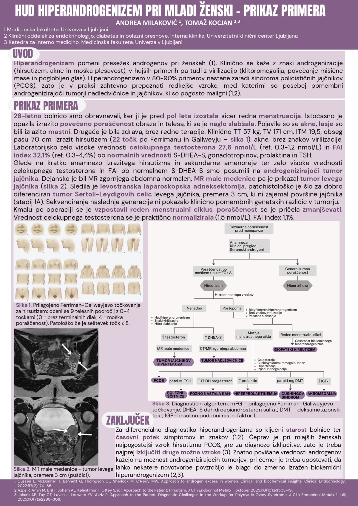 HUDI HIPERANDROGENIZEM PRI MLADI ŽENSKI – PRIKAZ PRIMERA