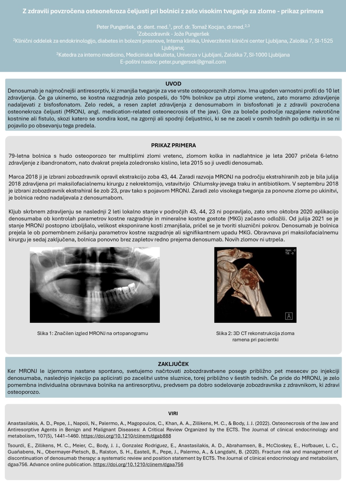 Z ZDRAVILI POVZROČENA OSTEONEKROZA ČELJUSTI PRI BOLNICI Z ZELO VISOKIM TVEGANJEM ZA ZLOME – PRIKAZ PRIMERA