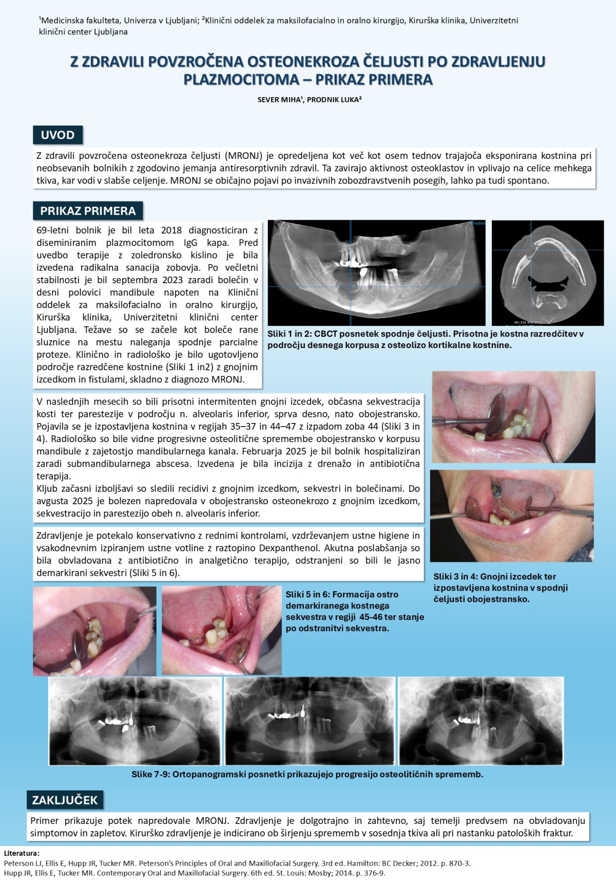 Z ZDRAVILI POVZROČENA OSTEONEKROZA ČELJUSTI PO ZDRAVLJENJU PLAZMOCITOMA – PRIKAZ PRIMERA