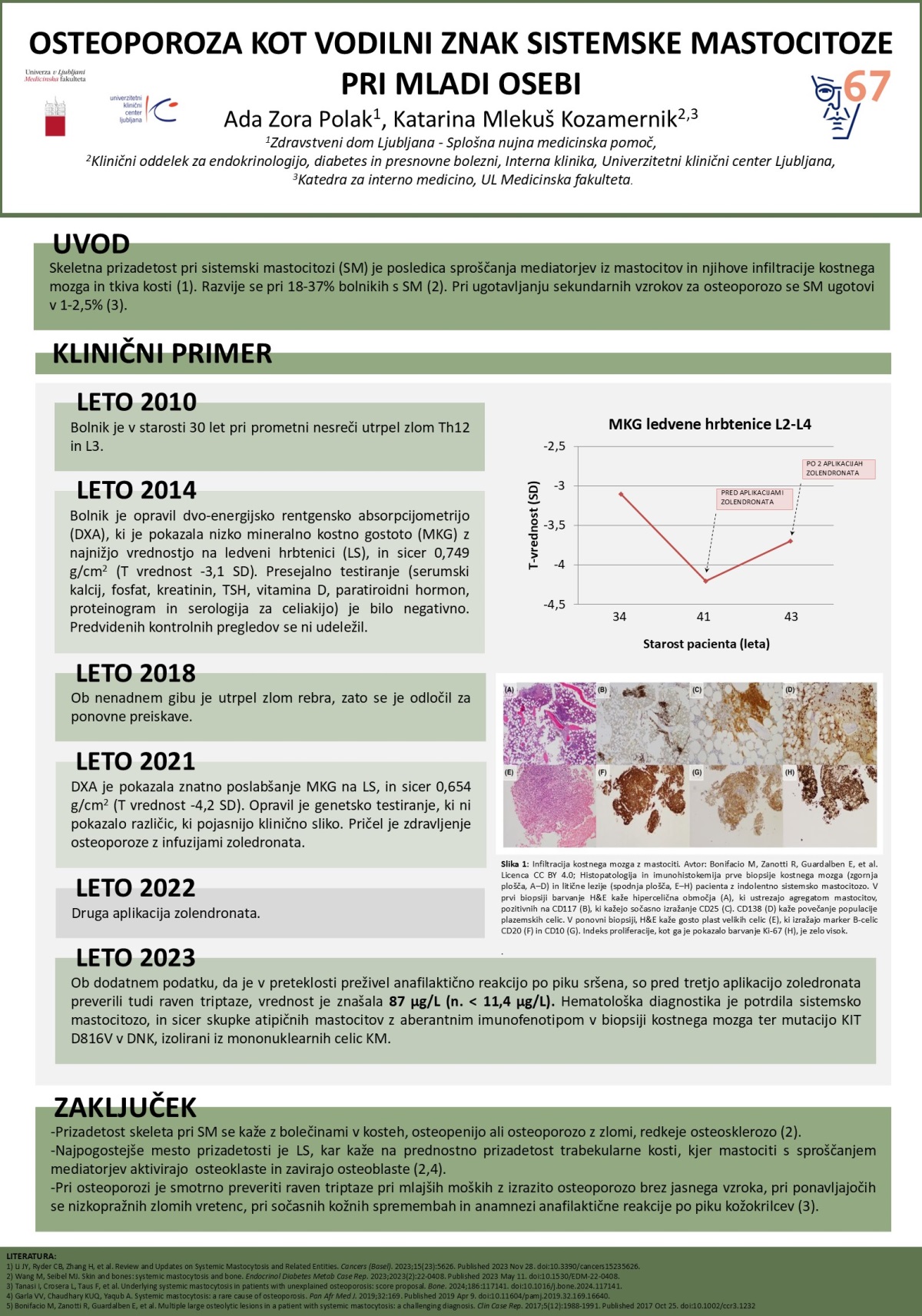 OSTEOPOROZA KOT VODILNI ZNAK SISTEMSKE MASTOCITOZE PRI MLADI OSEBI