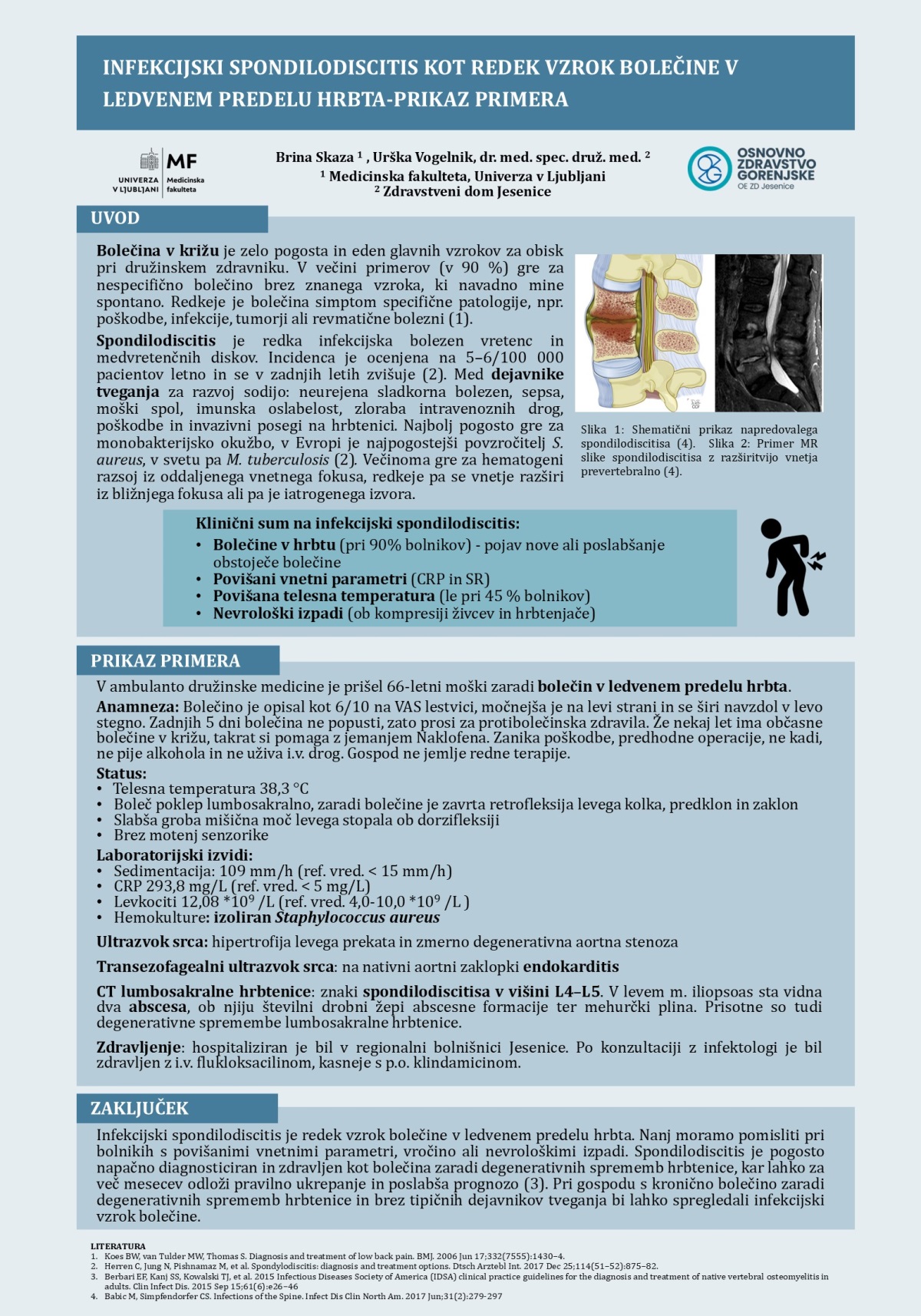 INFEKCIJSKI SPONDILODISCITIS KOT REDEK VZROK BOLEČINE V LEDVENEM PREDELU HRBTA – PRIKAZ PRIMERA