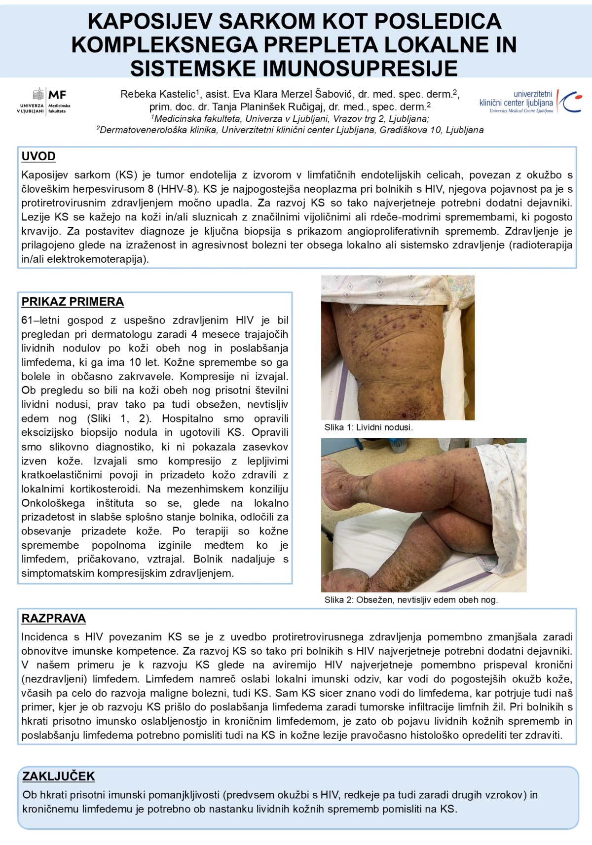 KAPOSIJEV SARKOM KOT POSLEDICA KOMPLEKSNEGA PREPLETA LOKALNE IN SISTEMSKE IMUNOSUPRESIJE – PREDSTAVITEV KLINIČNEGA PRIMERA