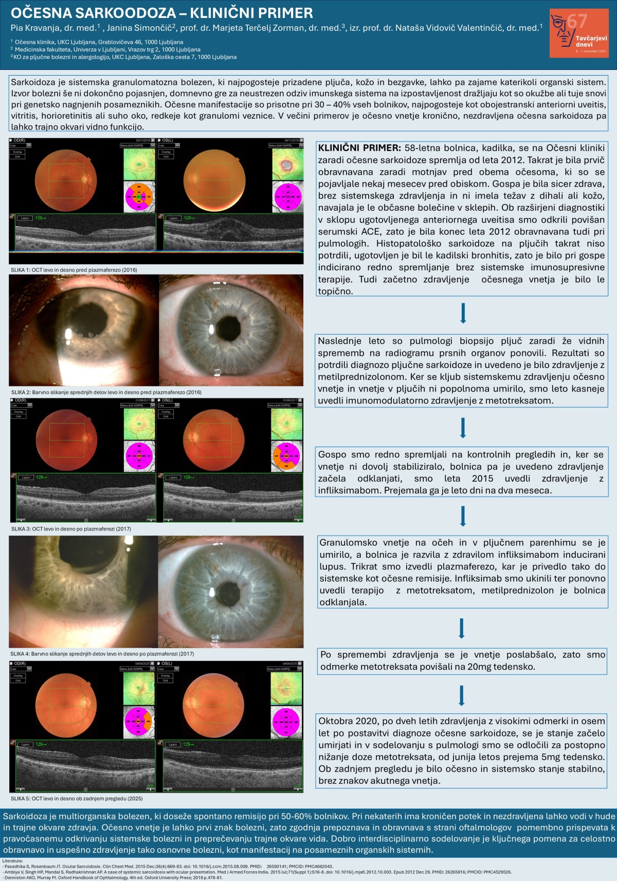 OČESNA SARKOIDOZA – KLINIČNI PRIMER