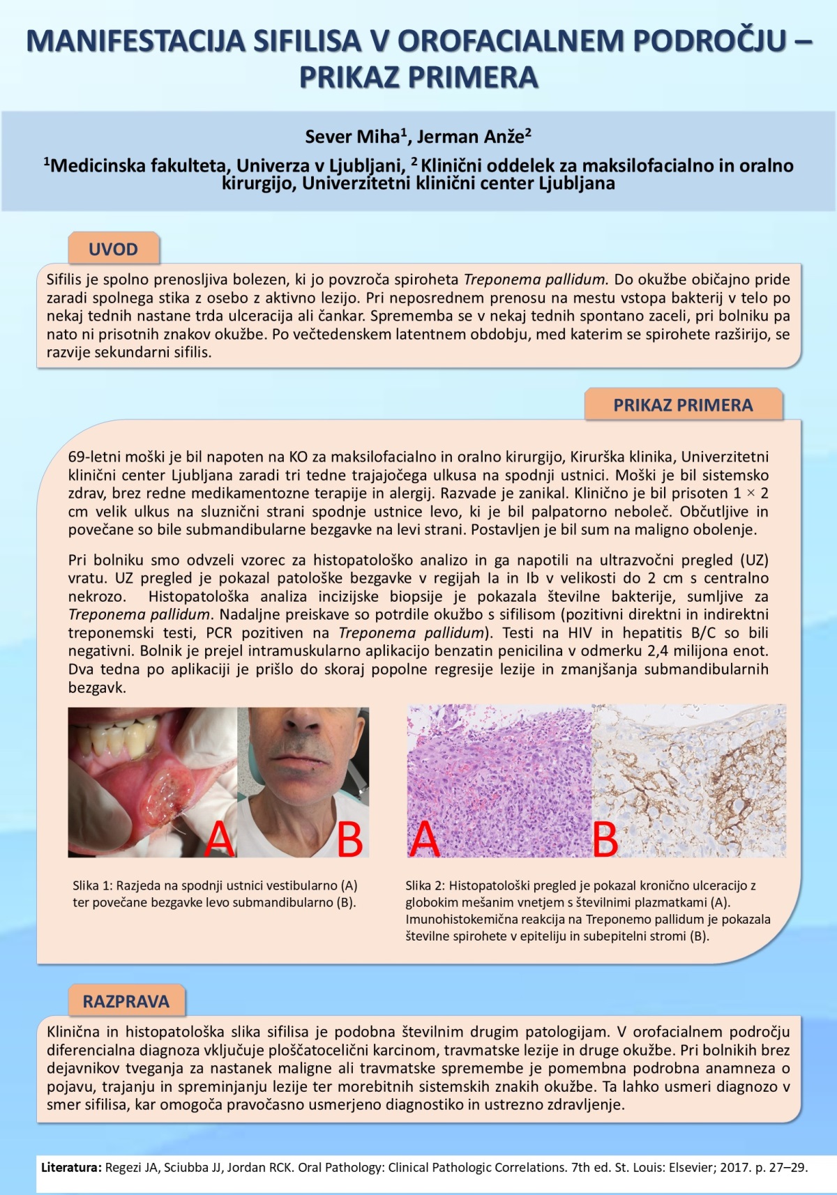 MANIFESTACIJA SIFILISA V OROFACIALNEM PODROČJU – PRIKAZ PRIMERA
