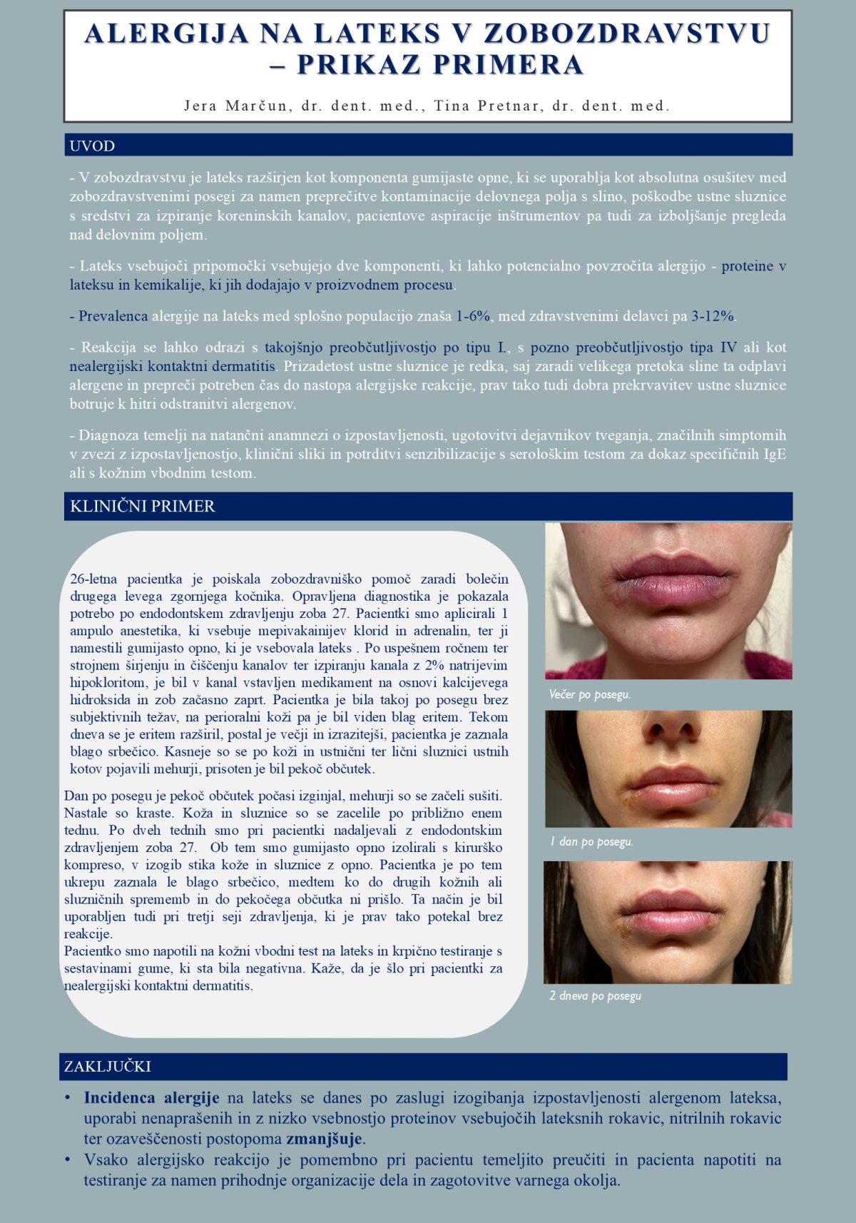 ALERGIJA NA LATEKS V ZOBOZDRAVSTVU – PRIKAZ PRIMERA