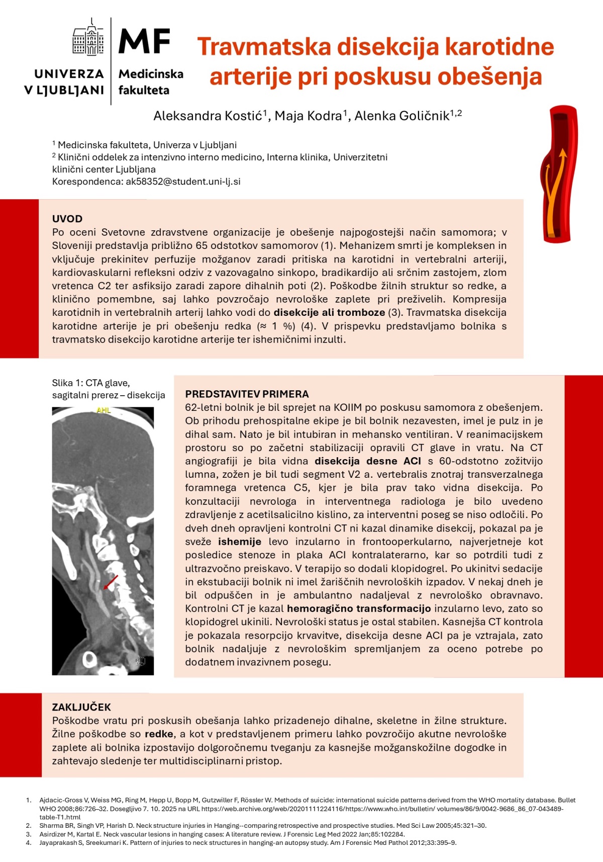 TRAVMATSKA DISEKCIJA KAROTIDNE ARTERIJE PRI POSKUSU OBEŠENJA