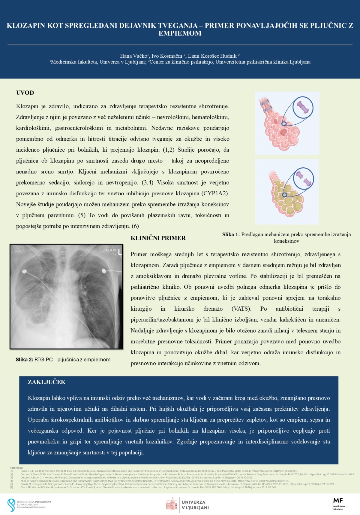 KLOZAPIN KOT SPREGLEDANI DEJAVNIK TVEGANJA – PRIMER PONAVLJAJOČIH SE PLJUČNIC Z EMPIEMOM
