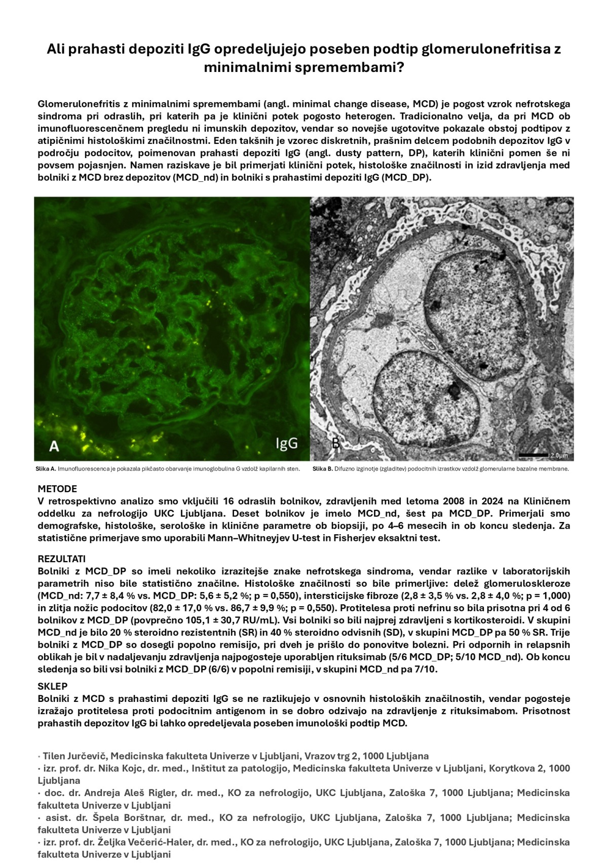 ALI PRAHASTI DEPOZITI IgG OPREDELJUJEJO POSEBNI PODTIP GLOMERULONEFRITISA Z MINIMALNIMI SPREMEMBAMI