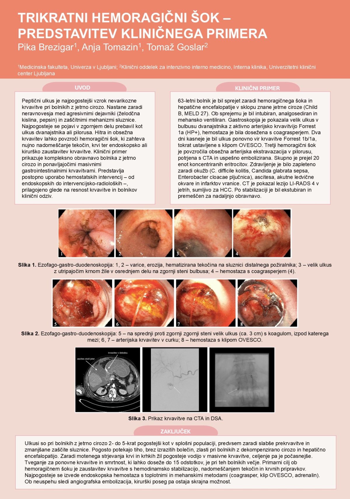 TRIKRATNI HEMORAGIČNI ŠOK – PREDSTAVITEV KLINIČNEGA PRIMERA