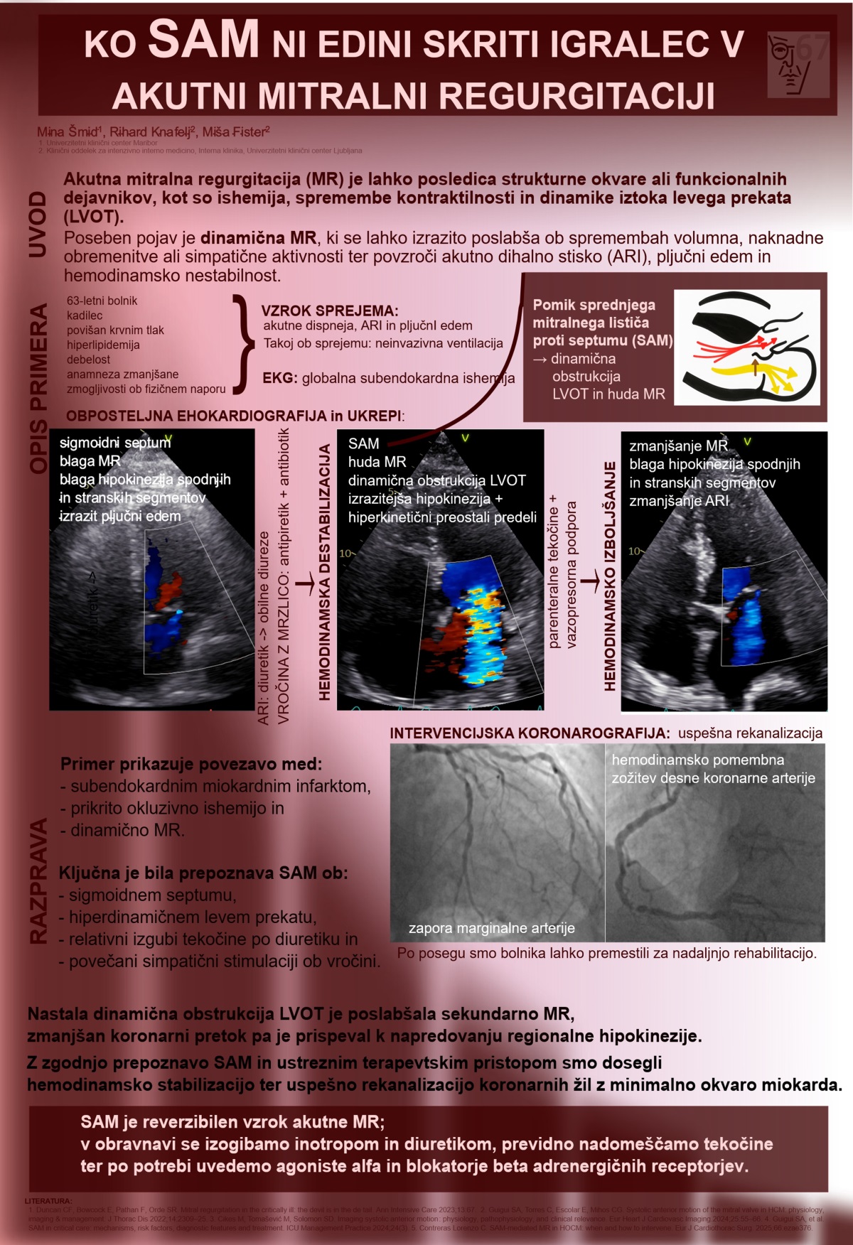 KO SAM NI EDINI SKRITI IGRALEC V AKUTNI MITRALNI REGURGITACIJI