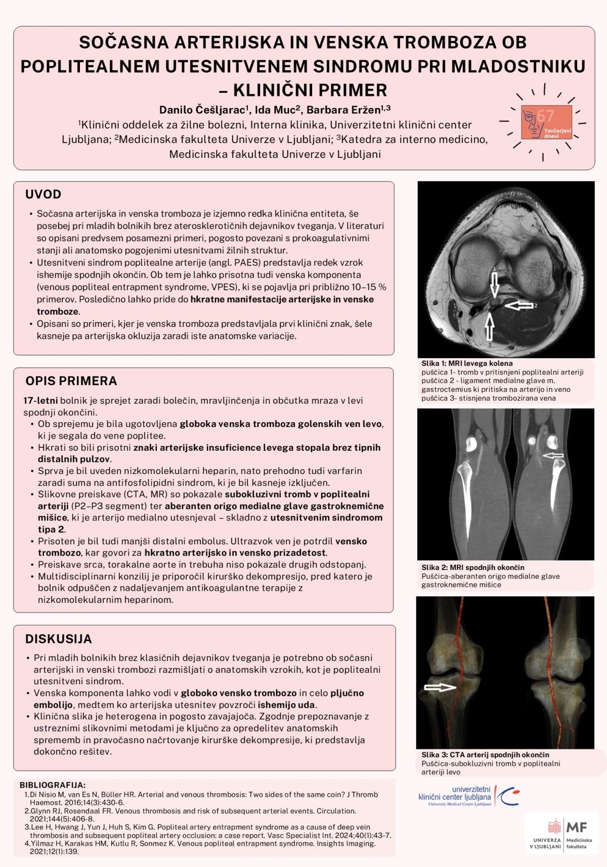SOČASNA ARTERIJSKA IN VENSKA TROMBOZA OB POPLITEALNEM ENTRAPMENT SINDROMU PRI MLADOSTNIKU – KLINIČNI PRIMER