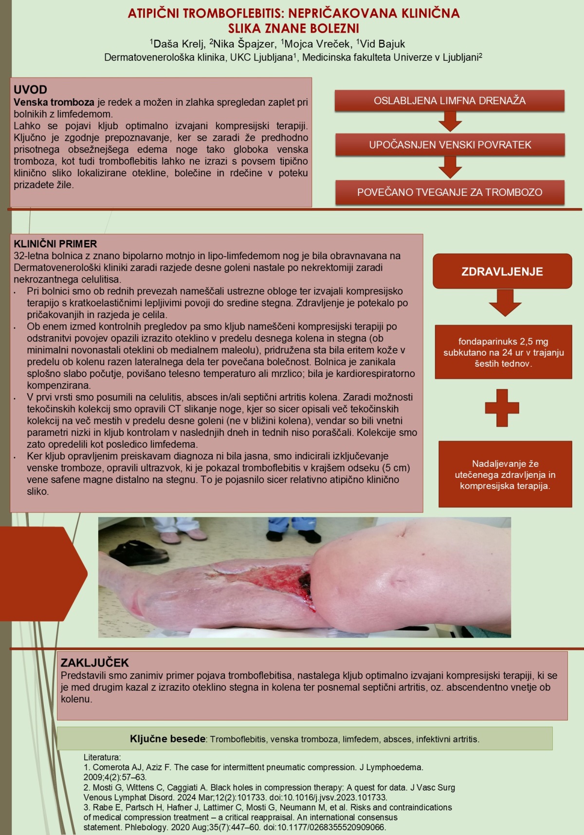 ATIPIČNI TROMBOFLEBITIS – NEPRIČAKOVANA KLINIČNA SLIKA ZNANE BOLEZNI