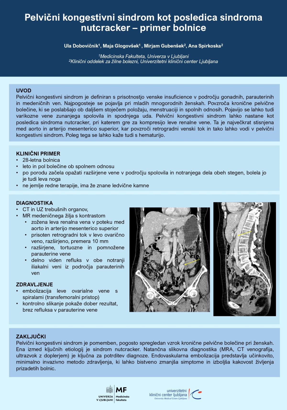 PELVIČNI KONGESTIVNI SINDROM KOT POSLEDICA SINDROMA NUTCRACKER – PRIMER BOLNICE