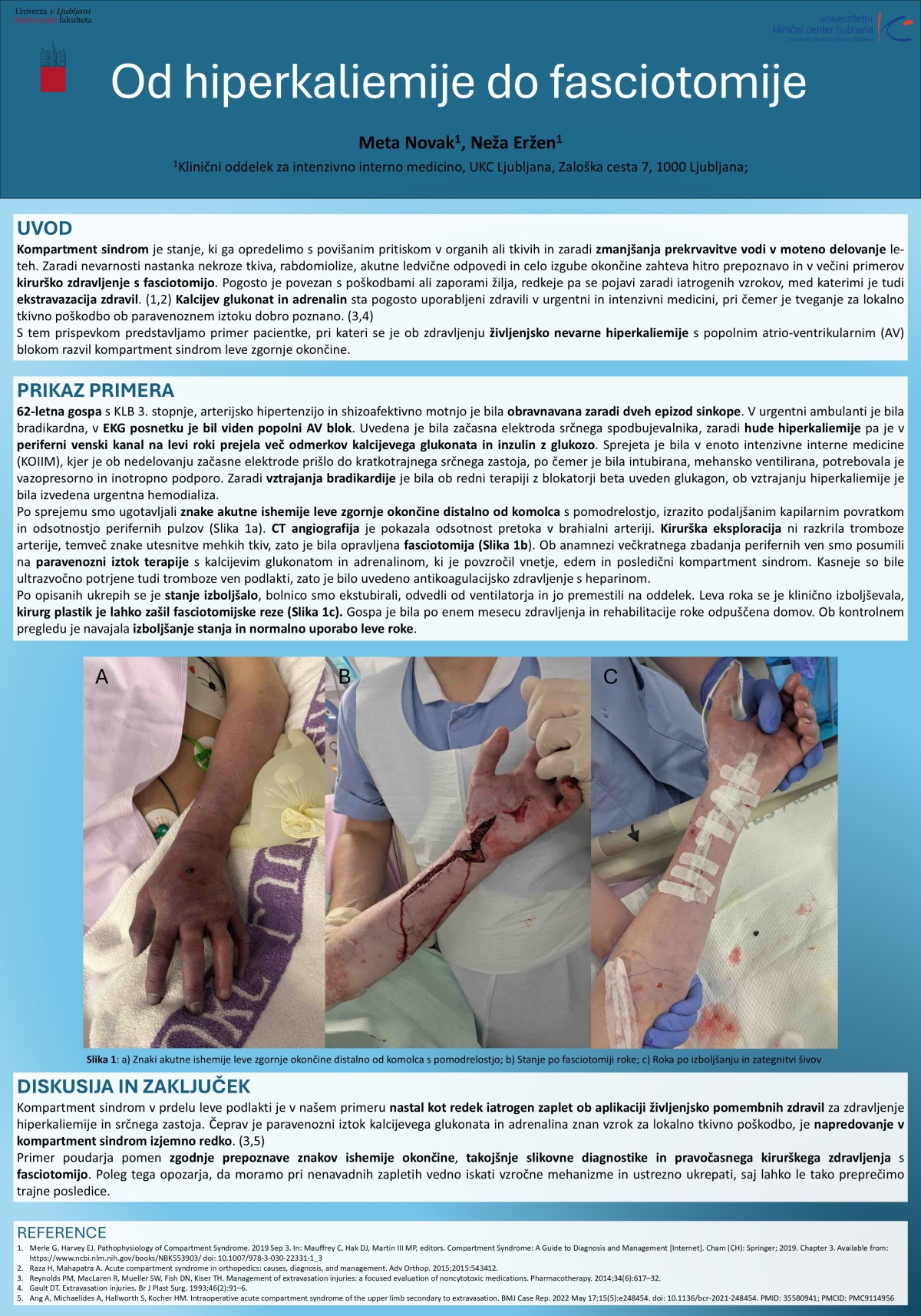 OD HIPERKALIEMIJE DO FASCIOTOMIJE