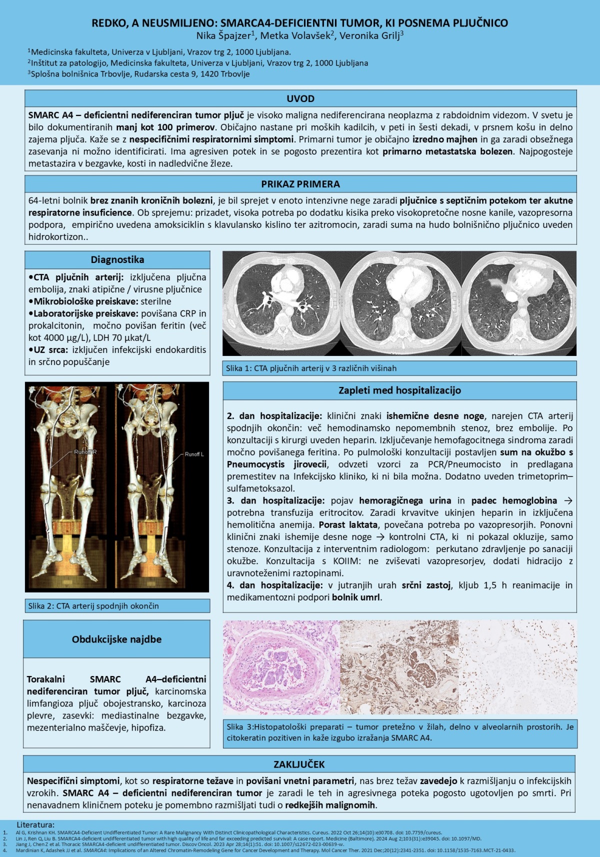 REDKO, A NEUSMILJENO: SMARC A4 – DEFICIENTNI TUMOR, KI POSNEMA PLJUČNICO