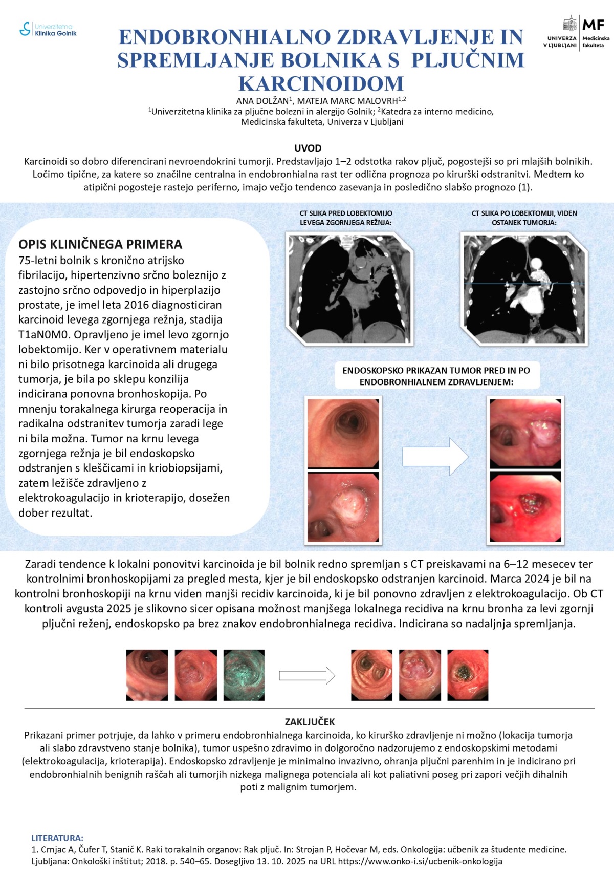 ENDOBRONHIALNO ZDRAVLJENJE IN SPREMLJANJE BOLNIKA S PLJUČNIM KARCINOIDOM